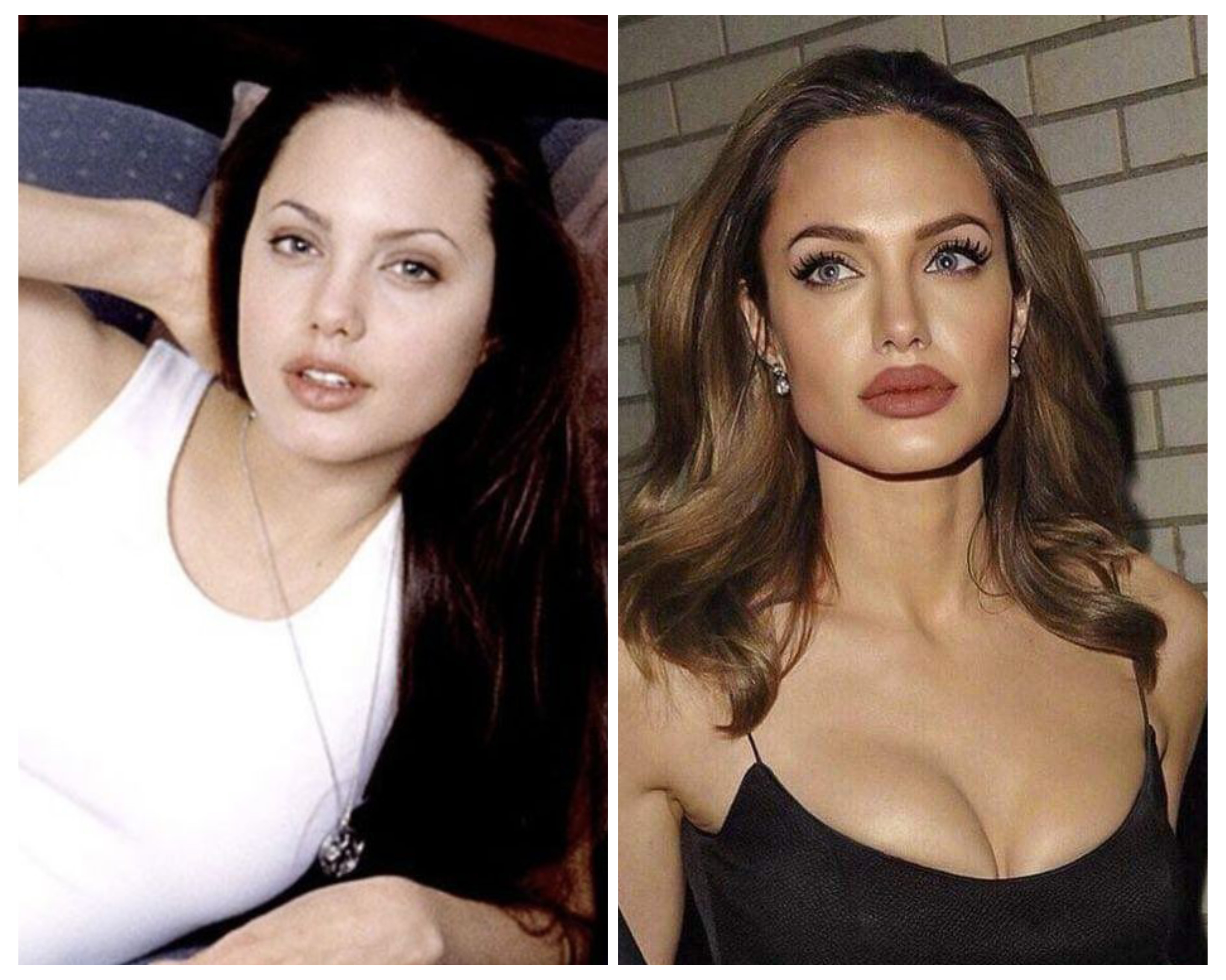 Angelina Jolie Before and After: Spotting the Surgery Signs