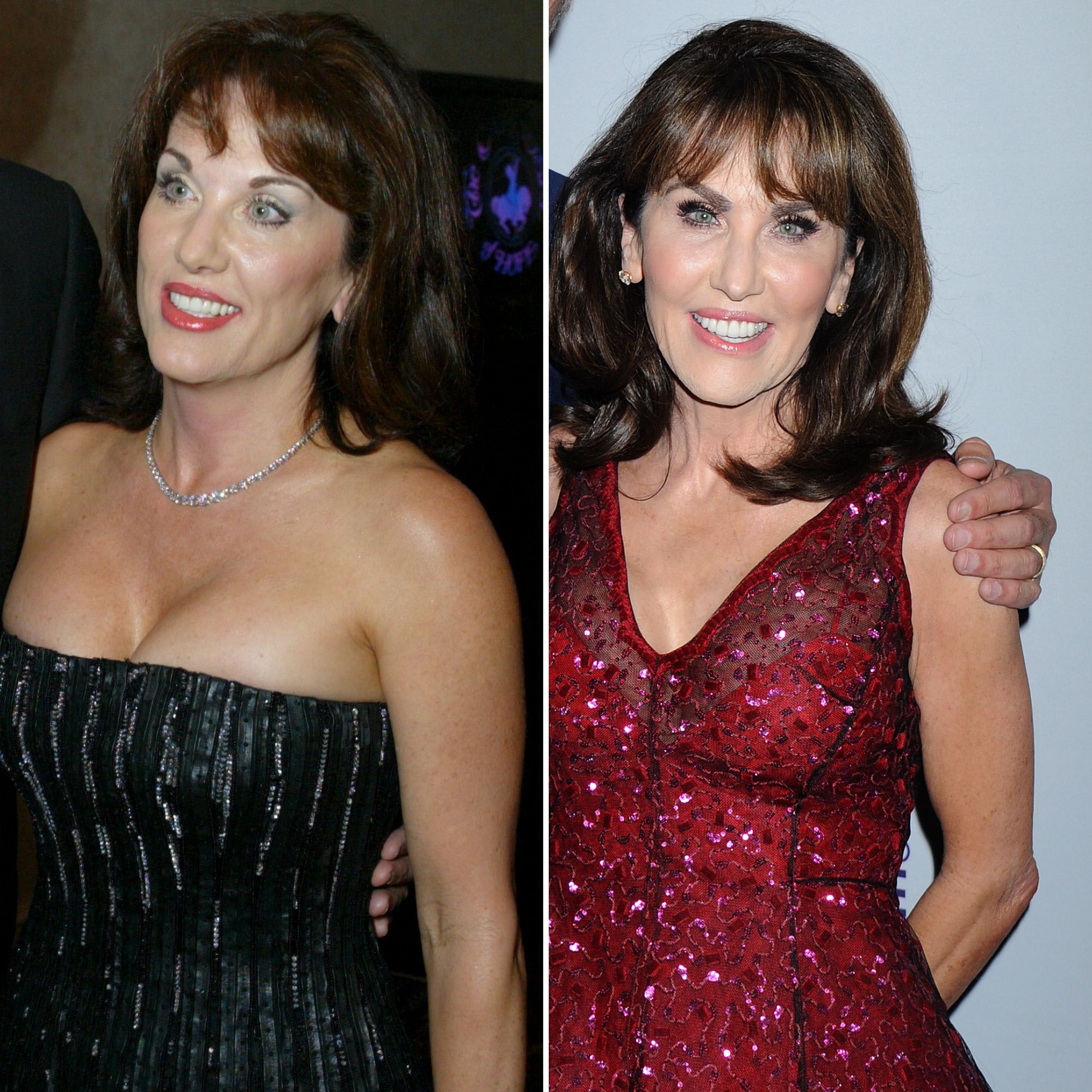 Has Robin McGraw Had Cosmetic Surgery? Find Out the Truth About Her Beauty Secrets!