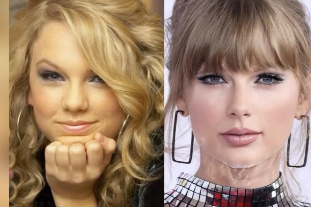 Taylor Swift Cosmetic Surgery Did She or Didnt She