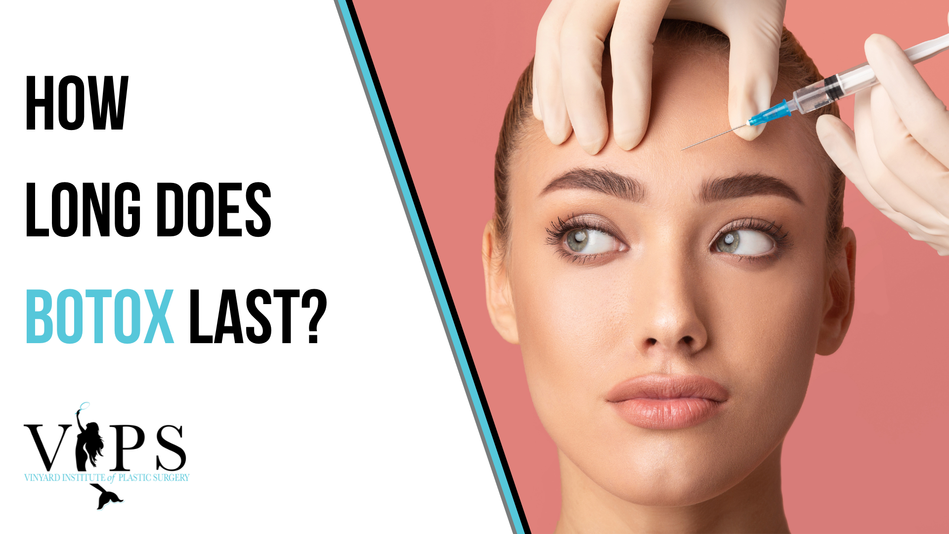 Curious about Botox? Find Out How Long Botox Cosmetics Last