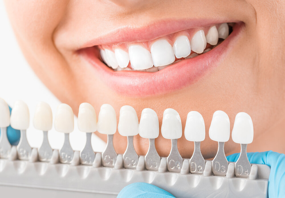 Want to Know How Much a Cosmetic Dentist Makes? Find Out Here