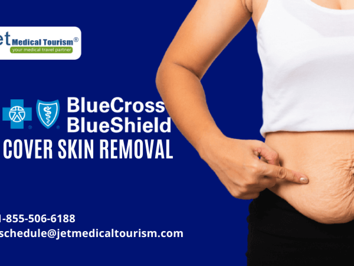 Your Questions Answered: Does Blue Cross Blue Shield Cover Cosmetic Surgery?