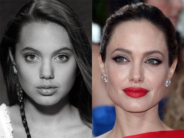 Angelina Jolie Before and After: Spotting the Surgery Signs