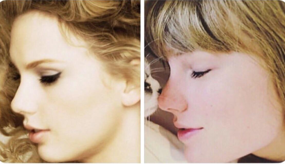 Taylor Swift Cosmetic Surgery Did She or Didnt She
