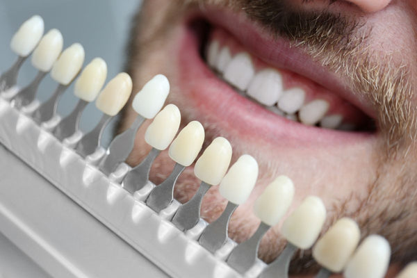 Thinking of Cosmetic Teeth Surgery? Heres a Quick Price Check