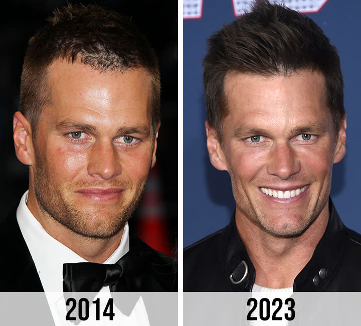 Did Tom Brady Have Cosmetic Surgery? The Rumors Explained Here!