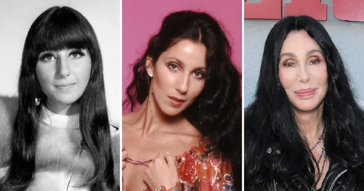 Has Cher Had Cosmetic Surgery? Here Is What We Know About Her Beauty Secrets!