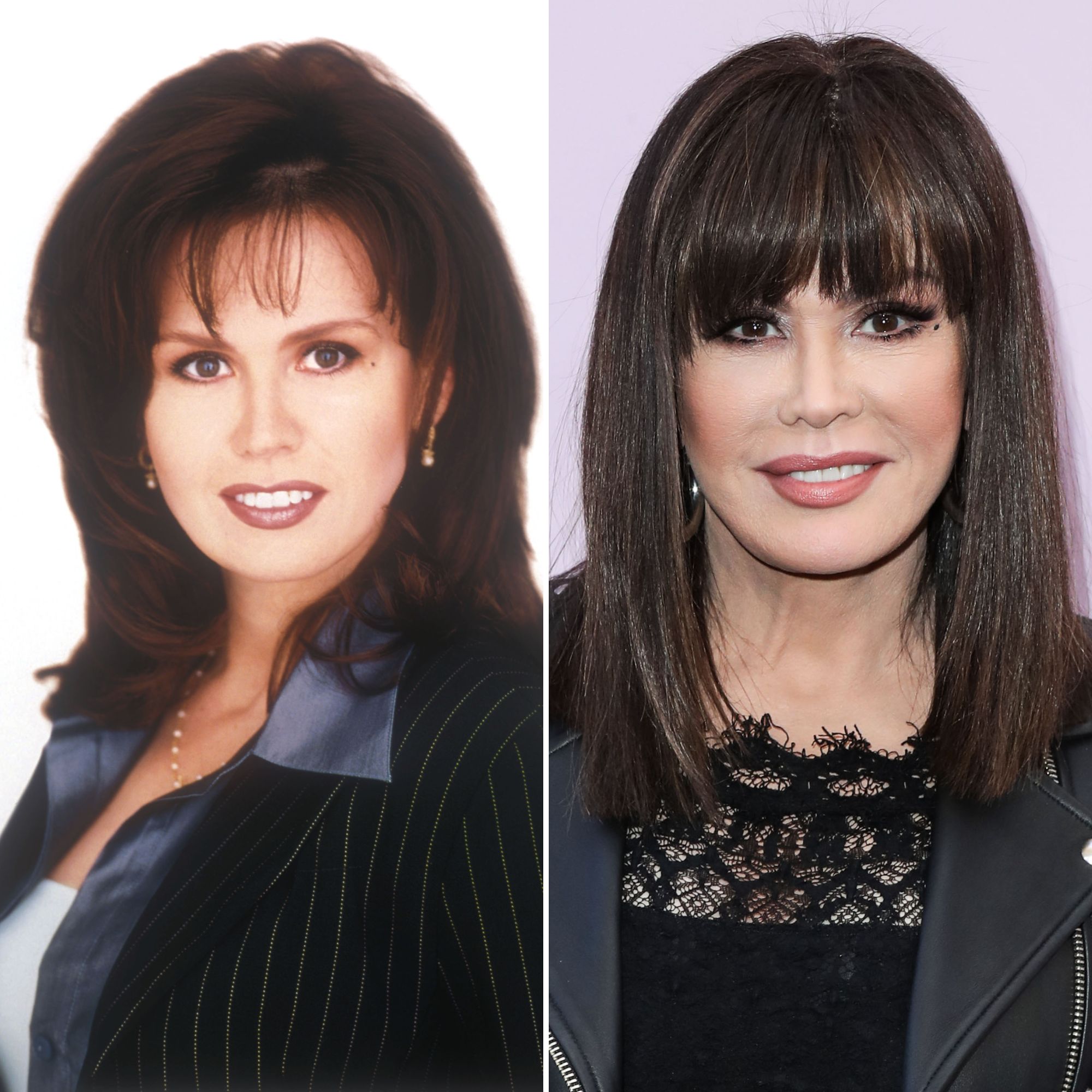 How Much Cosmetic Surgery Has Marie Osmond Had? Lets Find Out!