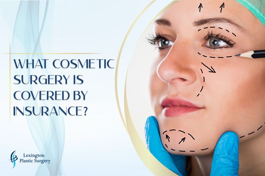 Will Insurance Cover Cosmetic Surgery? Heres What You Need to Know!